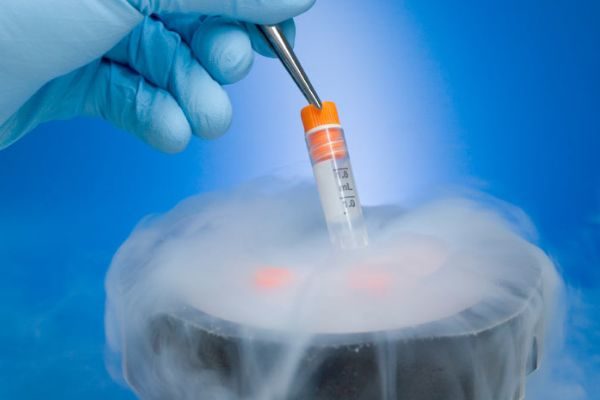 Криоконсервация эмбрионов ЭКО